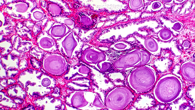 21-250666-AC_ISTP_MPHLW-Coalition_Web-Update-cytology Cells under a microscope