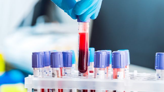 21-250666-AC_ISTP_MPHLW-Coalition_Web-Update_blood-draw Medical equipment. Blood test